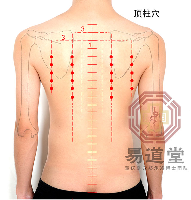 顶柱穴