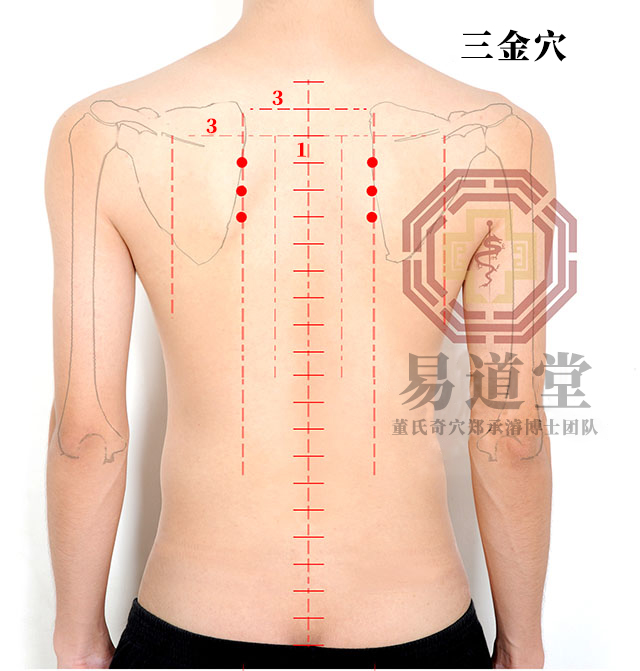 三金穴