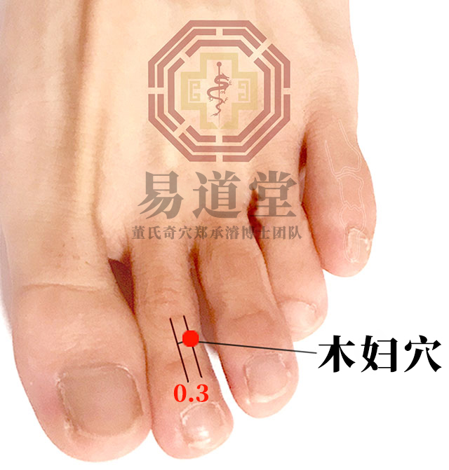 木妇穴