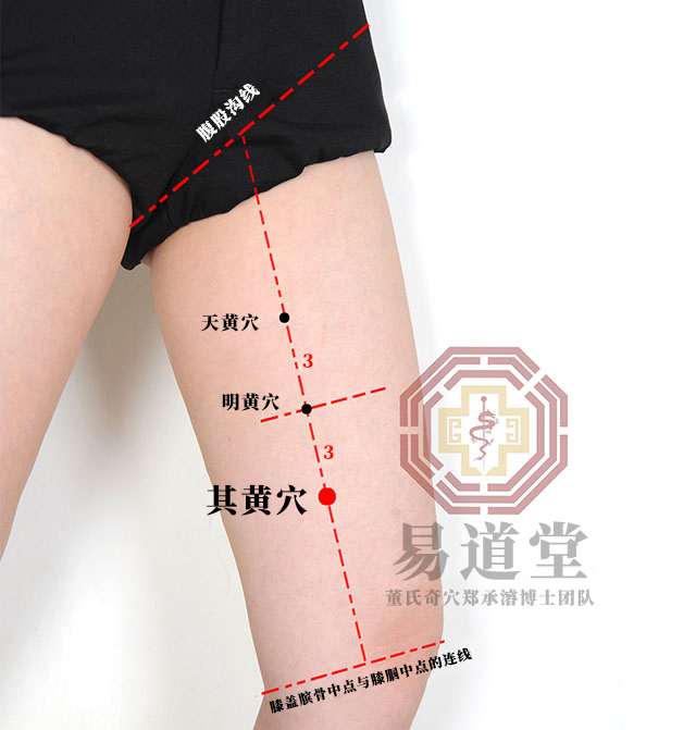 其黄穴