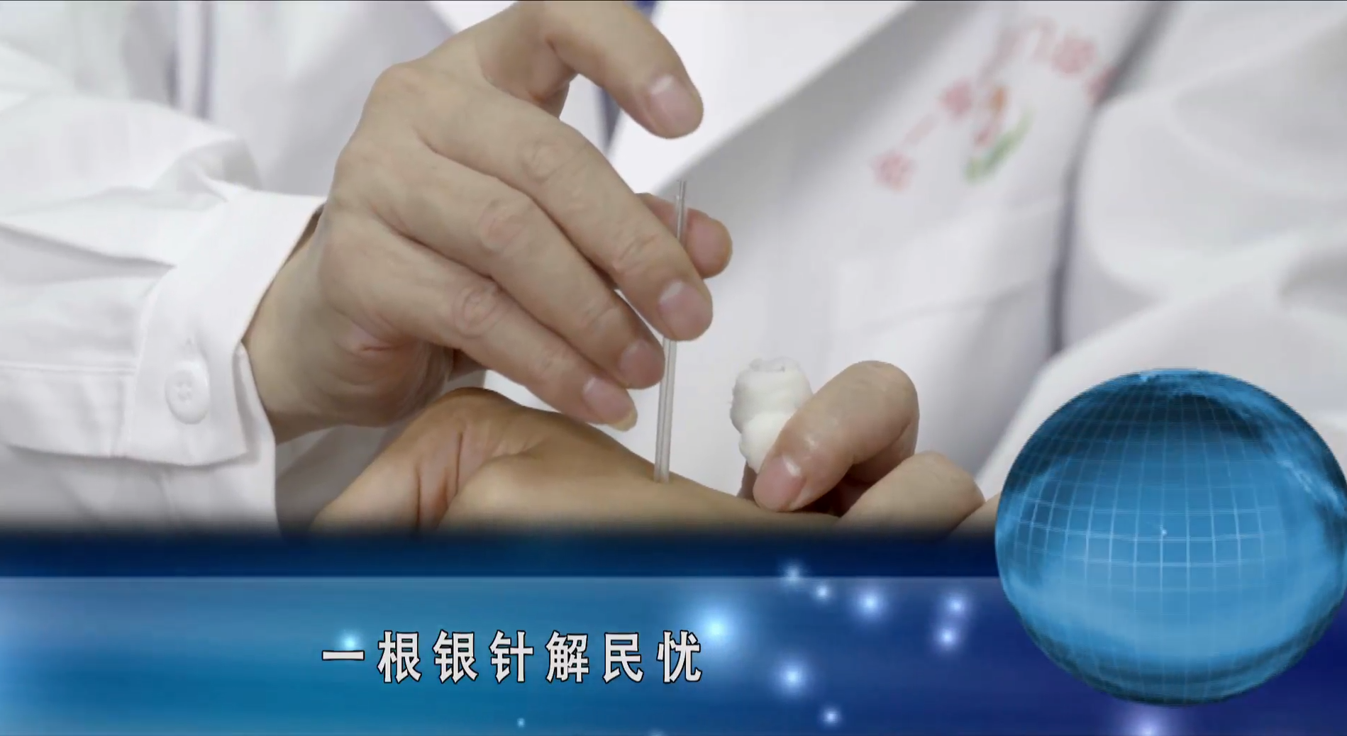 为什么要学针灸？这几个理由让你难以拒绝！